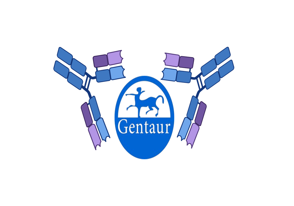  Rheumatoid Factors, rapid test 