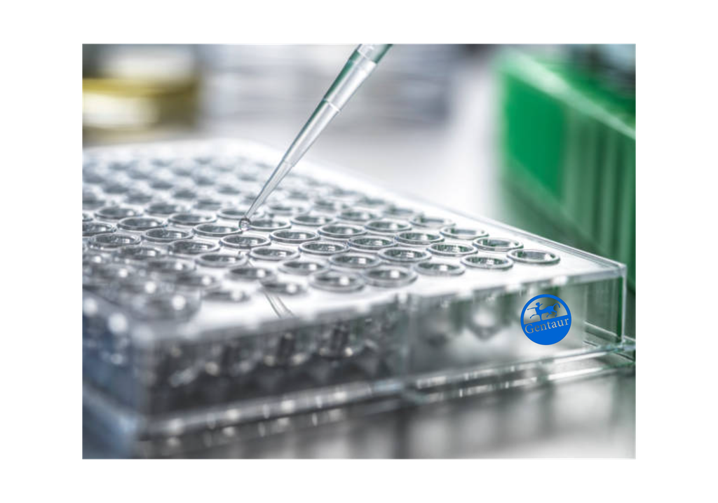 2019-nCoV (S) ELISA, Coronavirus